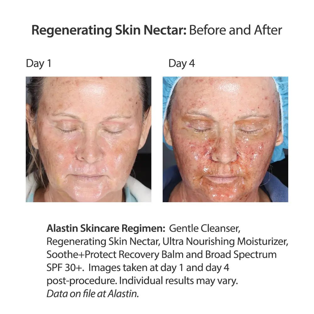 alastin regenerating skin nectar with trihex technology® - your skincare source