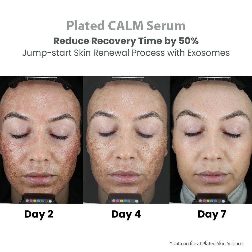 plated skin science calm serum - your skincare source