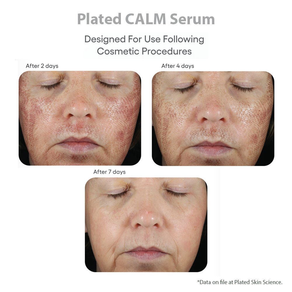 plated skin science calm serum - your skincare source