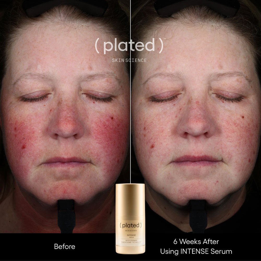 plated skin science intense serum - your skincare source