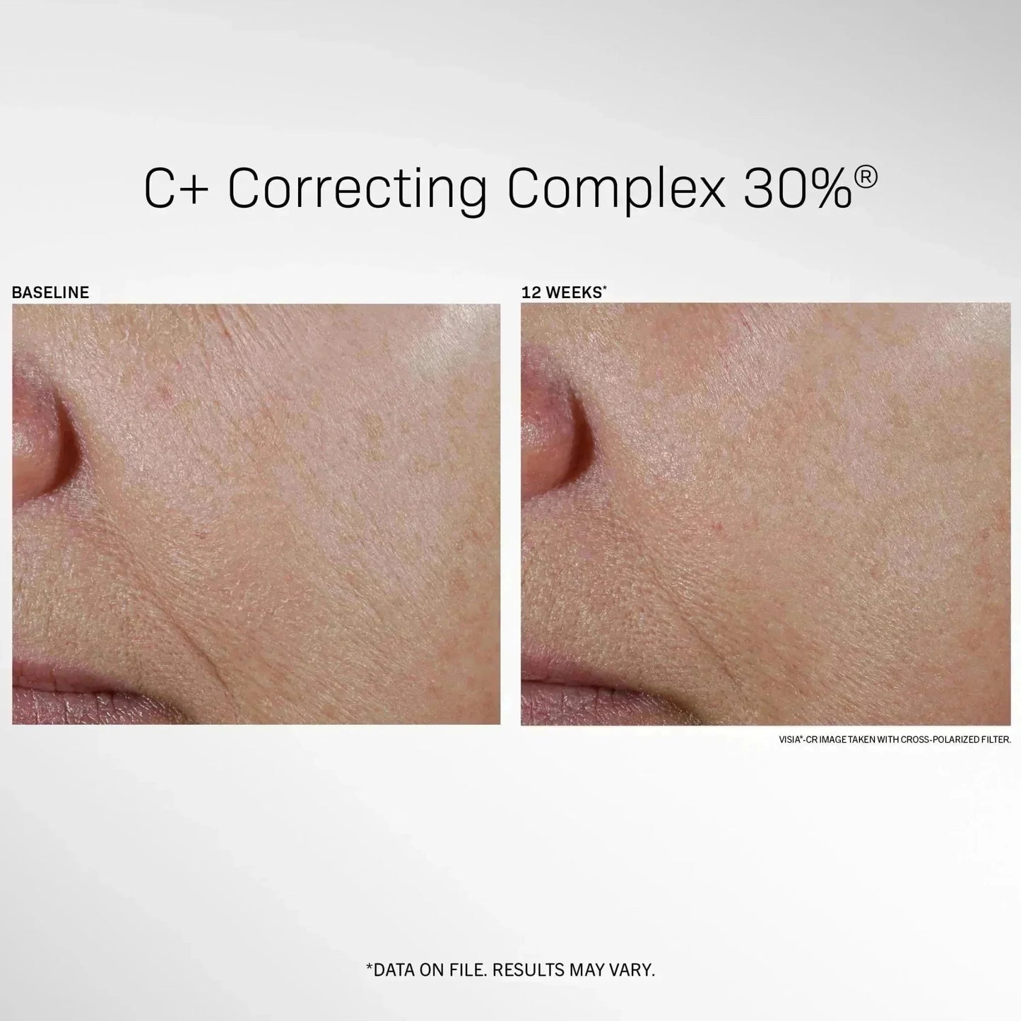 revision skincare c+ correcting complex 30%® 1 fl oz - your skincare source