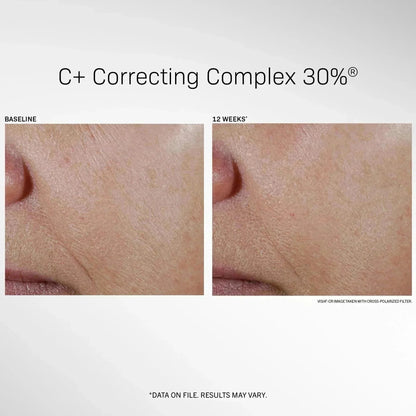 REVISION SKINCARE C+ Correcting Complex 30%® 1 FL OZ - Your Skincare Source